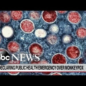 Biden administration declares monkeypox a public health emergency