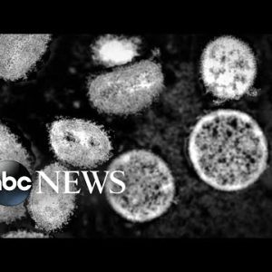 Biden administration declares monkeypox a public health emergency