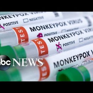 Monkeypox cases continue to grow; NYC declares state of emergency