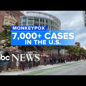 United States reports over 7,000 monkeypox cases