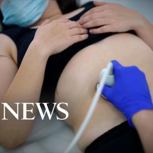 Prosecuting pregnancy loss: Women advocates fear post-Roe surge | ABCNL