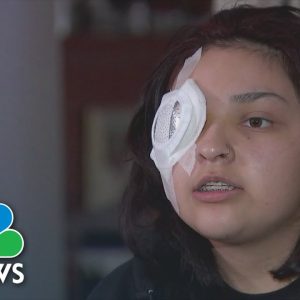 California Fast Food Worker To Lose Eye After Customer Attack