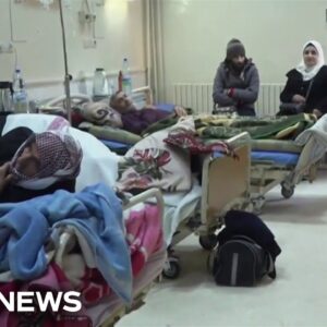 Hospitals in war-ravaged Syria struggle with shortages of supplies and equipment